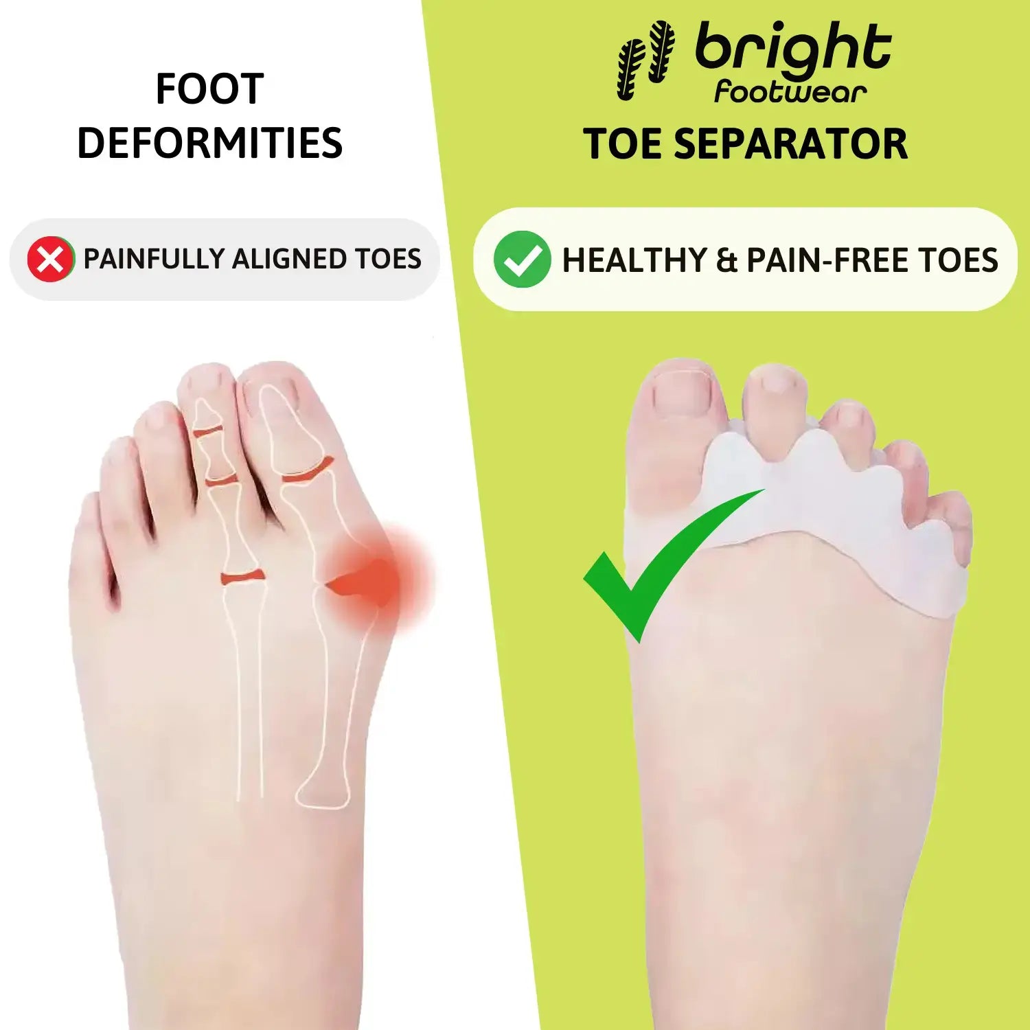 Toe Separator - Promotes Healthy Toes & Relieves Foot Pain